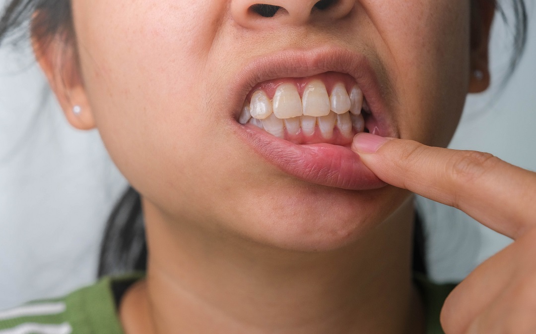 How to Protect Your Gum Health